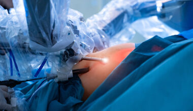 Kadın Hastalıklarında Robotik Cerrahi Teknolojisi…