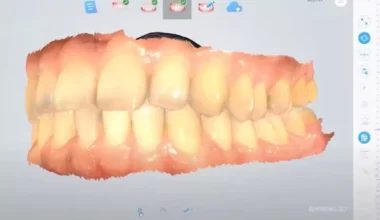 Diş hekimliğinde 3D tarayıcı ile ölçü alma derdi geride kaldı!
