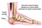 Nazlı Ekici ayak sağlığının gönüllü Podolog’u  Nazlı Ekici Türkiye ‘de rekor üstüne rekor kırmaya devam ediyor…