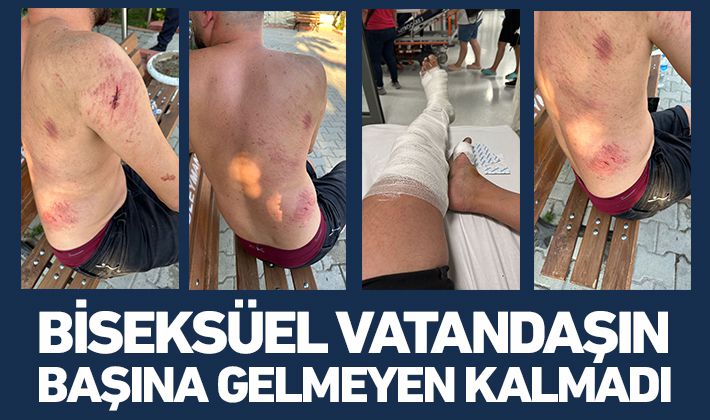 Biseksüel tercihi yüzünden işyeri Basıldı, Öldüresiye Dövüldü!