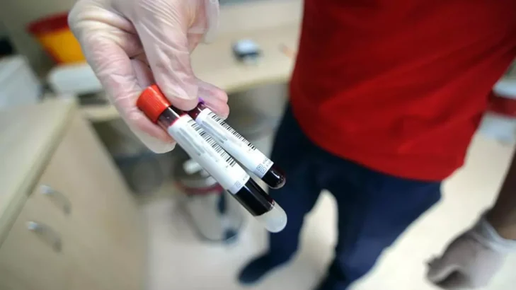 15 Yaşındaki Gencin Umut Veren Kanser Testi Neden Gerçek Olmadı?
